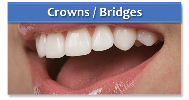 What Dental Crown Should You Choose? | Dental Healthcare Practice Horsham