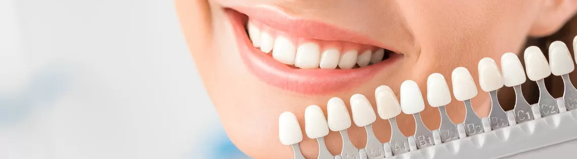 Teeth whitening instructions -woman with white teeth