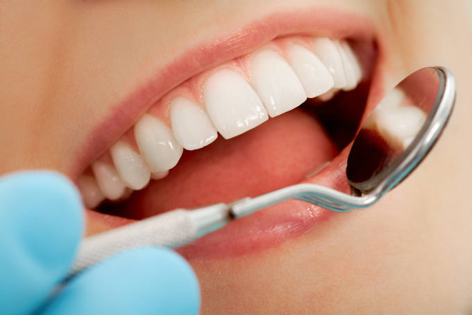 Finding the Best Material for Filling a Tooth Cavity - West Hollywood  Holistic and Cosmetic Dental Care